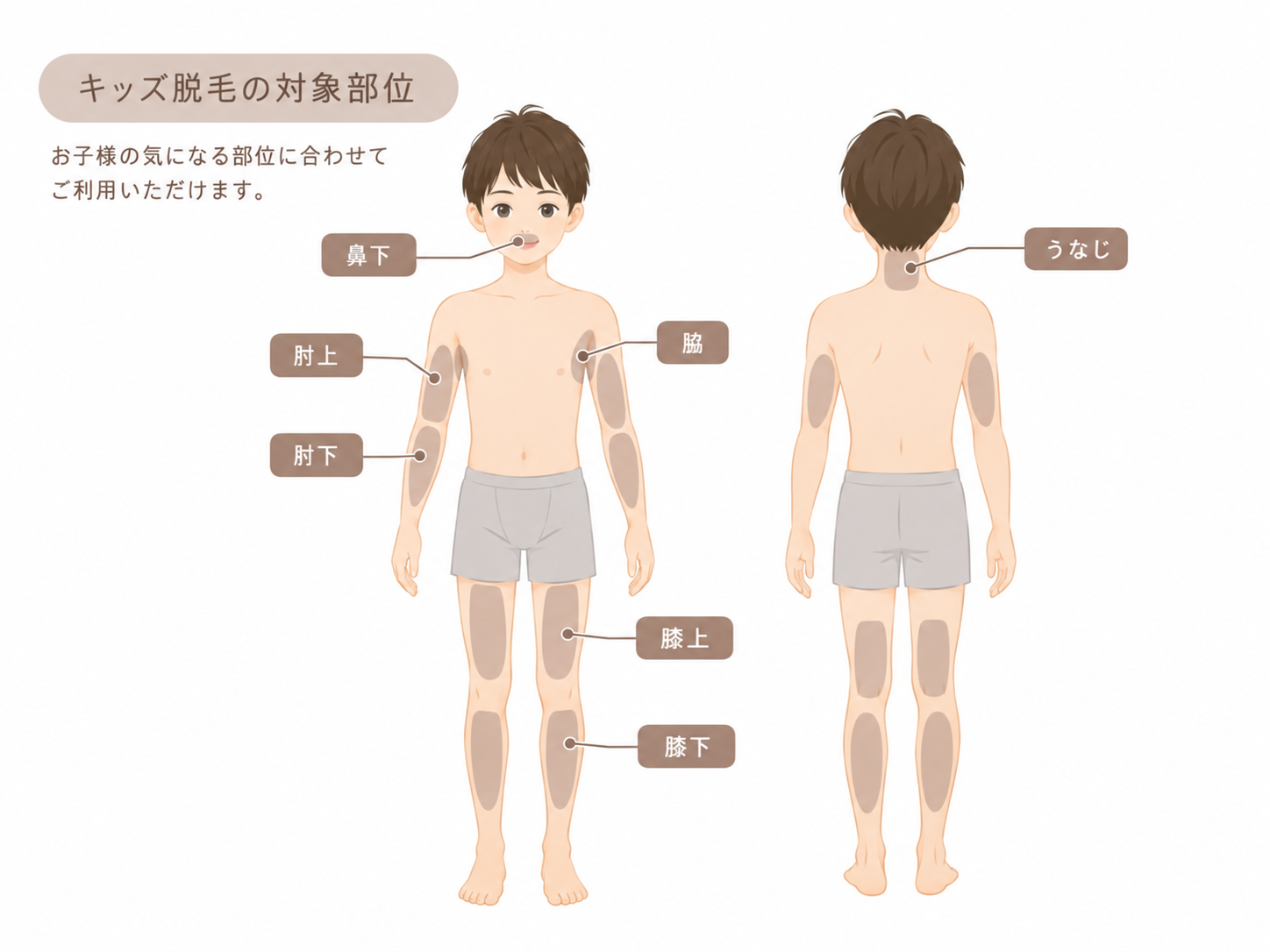 キッズ脱毛の対象部位
